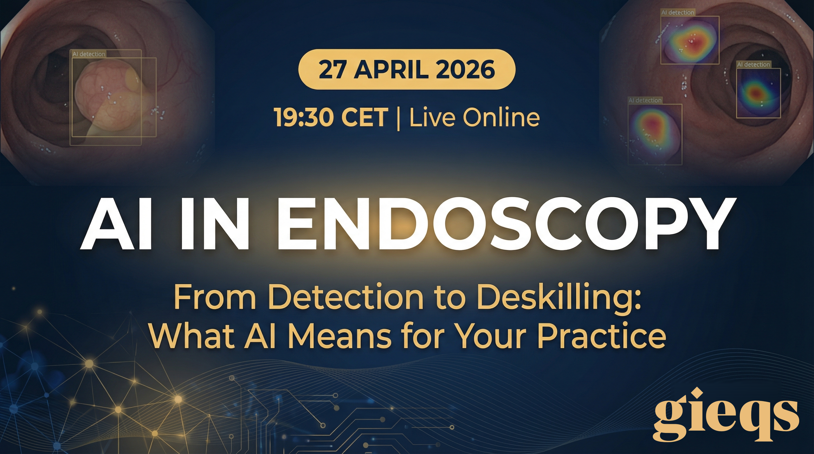 AI in Endoscopy