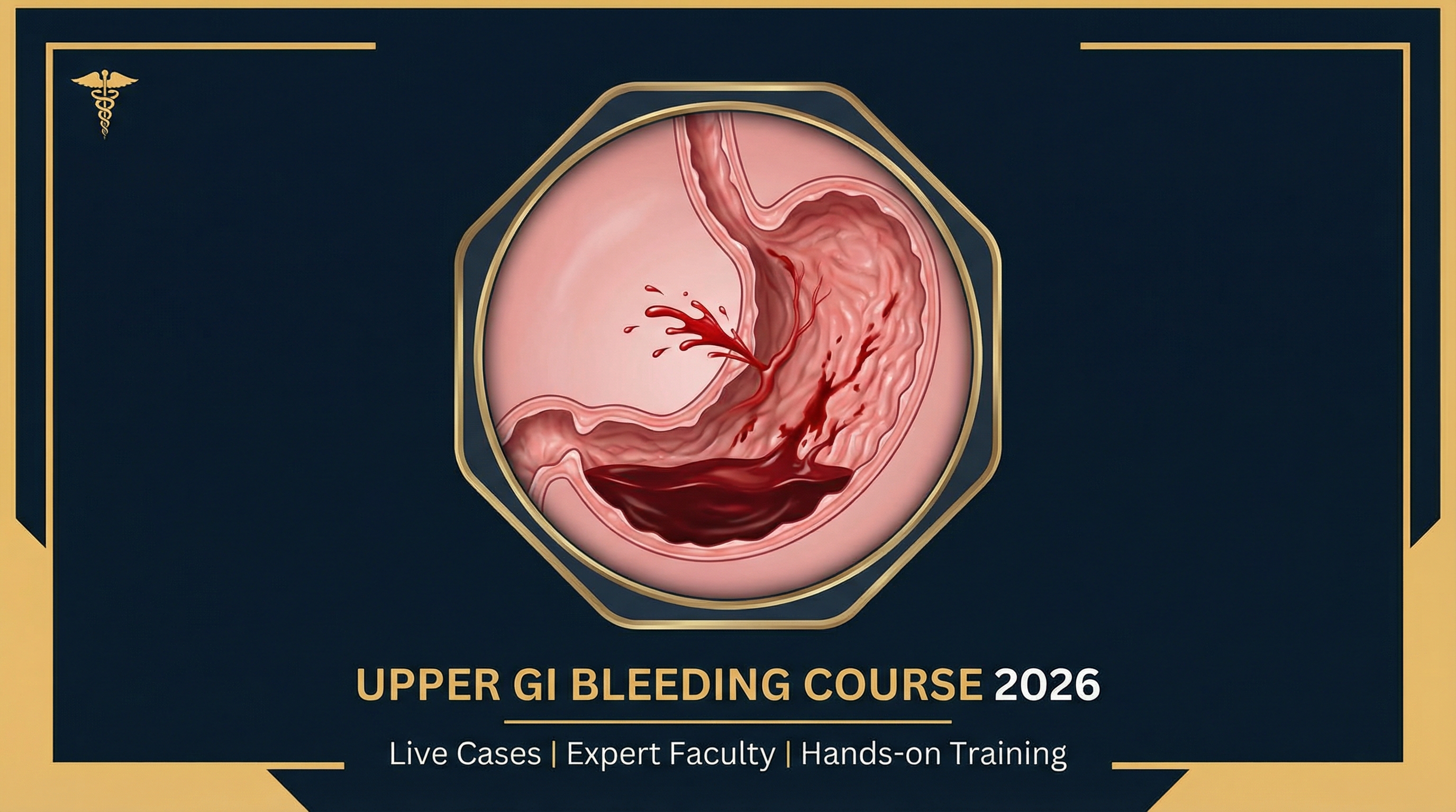 Upper GI Bleeding Masterclass